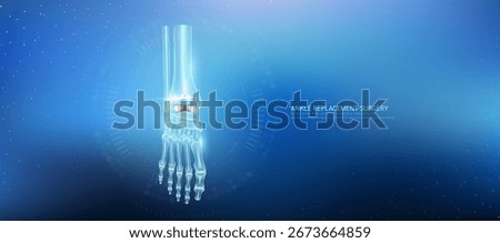 Total ankle replacement. Prosthetic implant integrated into the foot bone. Orthopedic technology artificial joint surgery in a transparent anatomical. Medical health care vector.