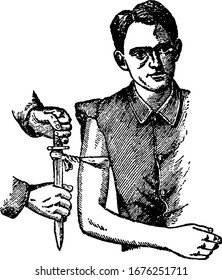 A tourniquet improvised to compress the right brachial. Twisting with a knife or stick is easy to apply pressure but also easy to cause other damage, vintage line drawing or engraving illustration.