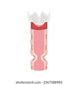 Tracheal stenosis awareness illustration. Trachea narrowing symbol. Difficulty breathing, hoarseness and voice change symptoms. Healthcare concept. Isolated flat vector illustration.