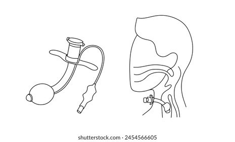 Tracheostomy and a man with a tracheostomy. An operation to create a surgical opening in the trachea to make breathing easier. Vector illustration