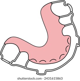 traditional dental retainer, oral care treatment, orthodontic - flat illustration 