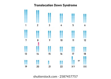 Translocation Down Syndrome Science Design. Vector Illustration.