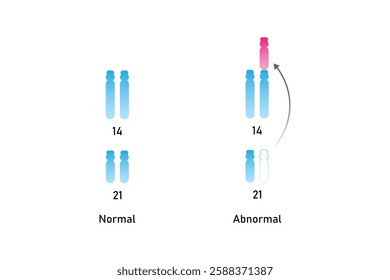 Translocation Down Syndrome Science Design. Vector Illustration.