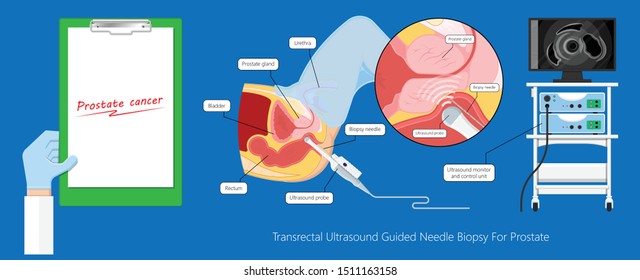 Cystoscopy Images, Stock Photos & Vectors | Shutterstock