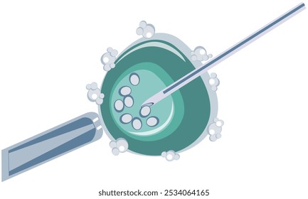 Punción transvaginal de folículos con una aguja, colección de óvulos, etapa de fertilización in vitro, FIV - Vector, ilustración a color