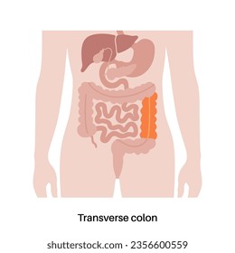 Transverse colon poster. Large intestine in the human body. Gastrointestinal disease, diagnostic and treatment in gastroenterology clinic. Digestive tract, examination of bowel vector illustration