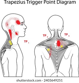 Trapezius Trigger Point Diagram Vector