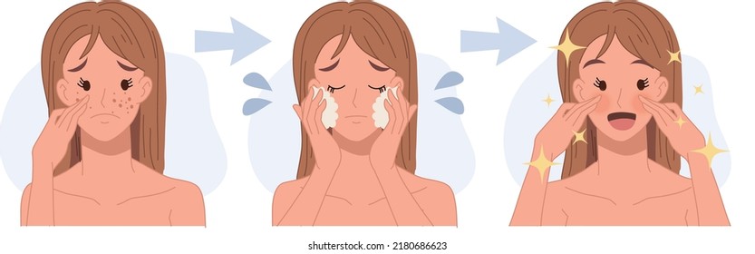 Treat Acneskin Problempimple Woman Facebeautifulbefore Afterstep Stock