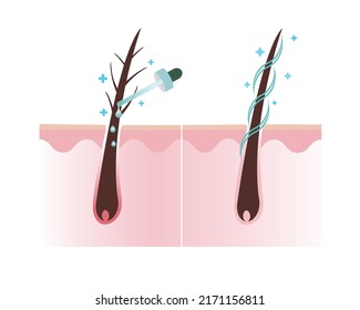 Treat damage hair with treatment and healthy hair scalp layer vector on white background. Hair care concept illustration. - Shutterstock ID 2171156811