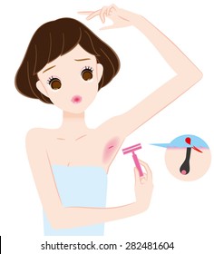 The treated hair of underarm. Injury