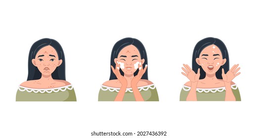 Treatment of acne. The Korean woman washes and cleanses the skin. Facial treatments that protect the skin of the face and preserve beauty. Skin care. Vector illustration