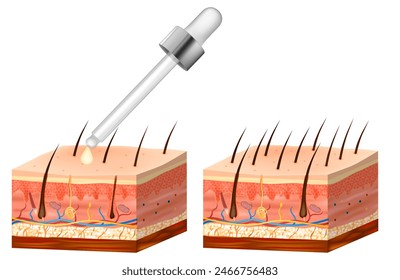 Treatment of alopecia vitamins hair. Number of hair on scalp before and after of treatment loss.