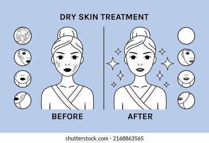 Treatment Of Dry Skin. Woman With Dry Skin On Face. Before After. Clean Healthy Skin. Icons And Closeup Of Skin Problems. Zoom. Flat Cartoon Fashion Line Style. Black White Color. Vector Illustration.