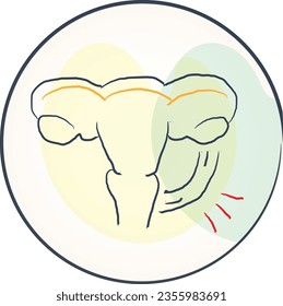 El tratamiento de la endometriosis generalmente implica medicación o cirugía