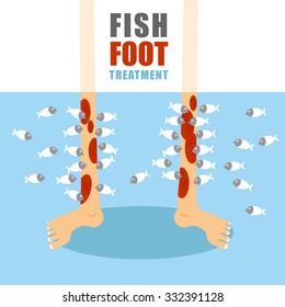 Treatment foot fish. Medical procedure for therapy of psoriasis and skin diseases. Small fishes eat painful human leather. Lower limbs standing in water with marine animals