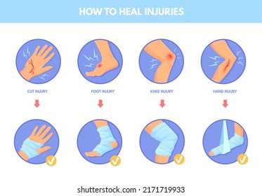 El tratamiento hirió al deporte. Pata del brazo lesionada por dolor cuerpo de sangrado de la piel, esguince del músculo vendaje curación lesión fractura del pie del tobillo mano rodilla humana, ilustración del vector. Trauma en la pierna, dolor y tratamiento