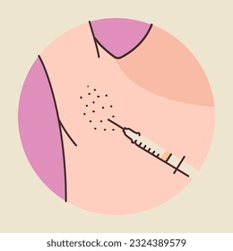 Treatment of hyperhidrosis armpits color line illustration. Cosmetology skin care concept. 