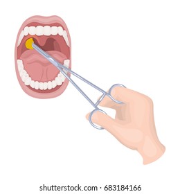 Treatment of the tonsils In the oral cavity. Medicine single icon in cartoon style vector symbol stock illustration web.