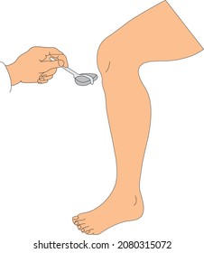 Triceps reflex examination with the neurological hammer. Basic neurological exam, muscle reflex examination.