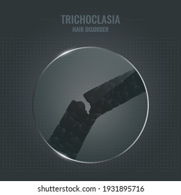 Trichoclasia damaged hair surface under microscope. Hair follicle brittle condition closeup trichoscopy vector. Problem of fragility and breakage. Trichology medical concept.