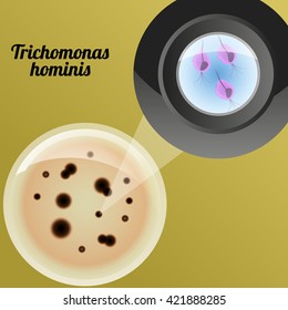 Trichomonas Hominis