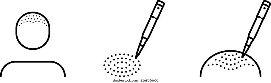 Trichopigmentation Of The Bald Head Icon , Vector