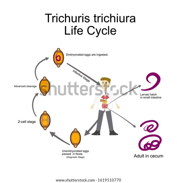 Trichuris Trichiura Life Cyclemedical Parasitologyparasitic Microscope 库存矢量图（免版税）1619510770 3566