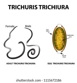 Trichuris trichiura structure of an adult. The structure of the egg Trichuris trichiura. Set. Infographics. Vector illustration on isolated background.