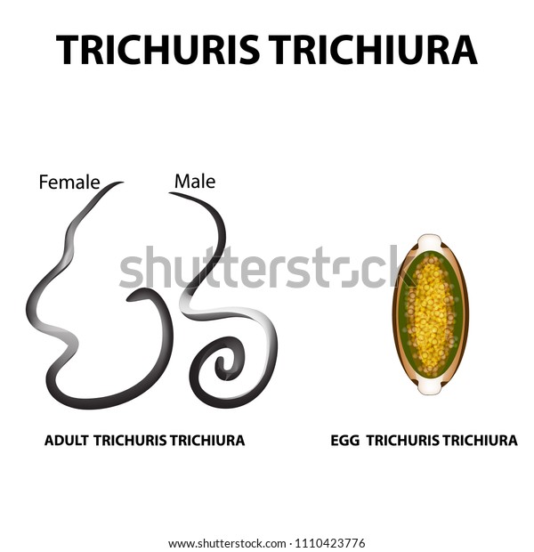 Pinworm trichocephalosis. Pinworm trichocephalosis