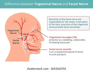 Trigeminal Nerve and Facial Nerve. Difference between Trigeminal Neuralgia and Facial Nerve Neuritis. Simple vector anatomy illustration in flat style.