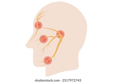 Trigeminal neuralgia,facial pain due to trigeminal nerve irritation. ,multiple sclerosis, cluster headaches, postherpetic neuralgia, and temporomandibular joint disorder.