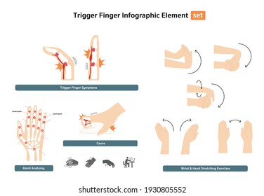 trigger finger infographic element set, office syndrome, finger abnormal symptoms from work with wrist and hand stretching exercises and icon set flat design