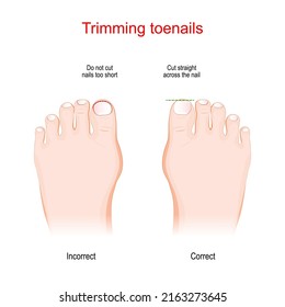 Trimming toenails. Incorrect and Correct procedure. Close-up of human foot and nails. vector illustration