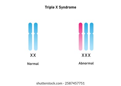 Triple X Syndrome Science Design. Vector Illustration.