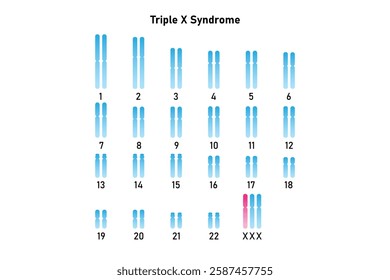 Triple X Syndrome Science Design. Vector Illustration.