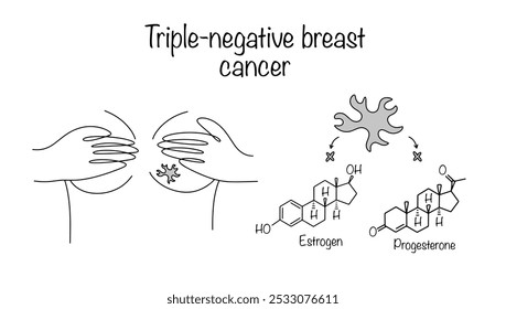 Câncer de mama triplo-negativo. Um tipo agressivo de câncer de mama que se caracteriza pela ausência de receptores para estrogênio e progesterona. Vetor médico desenhado à mão.