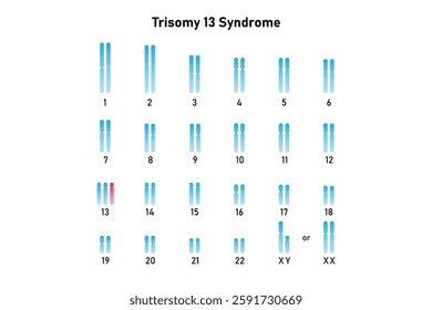 Trisomy 13 Syndrome Science Design. Vector Illustration.