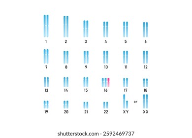 Trisomy 16 Syndrome Science Design. Vector Illustration.