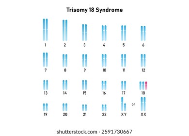 Trisomy 18 Syndrome Science Design. Vector Illustration.