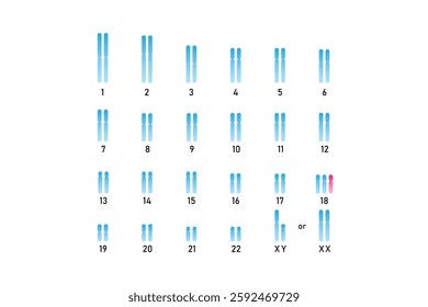 Trisomy 18 Syndrome Science Design. Vector Illustration.