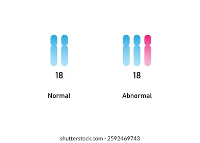 Trisomy 18 Syndrome Science Design. Vector Illustration.