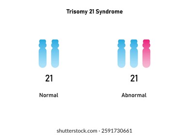 Trisomy 21 Syndrome Science Design. Vector Illustration.