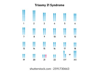 Trisomy 21 Syndrome Science Design. Vector Illustration.