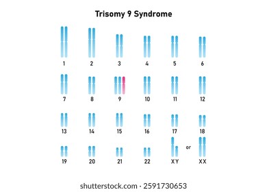 Trisomy 9 Syndrome Science Design. Vector Illustration.