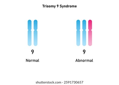 Trisomy 9 Syndrome Science Design. Vector Illustration.