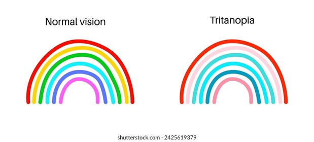 Tritanopia vision, color blindness infographic. Human vision deficiency concept. Difference between colors, brightness and intensity of shades. Eye abnormality flat vector illustration