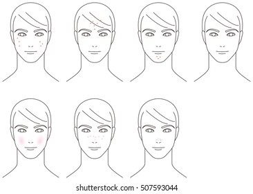 Trouble of the skin of the face. Acne. Man.
