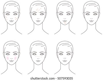Trouble of the skin of the face. Acne. woman.