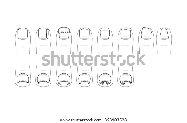 Trouble Toenails Ingrown Nail Stock Vector (Royalty Free) 353903528 ...