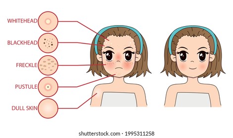 Troubled And Happy Woman And Set Of Female Facial Skin Problems Needs To Care About: Acne ,Freckle And Dull Skin